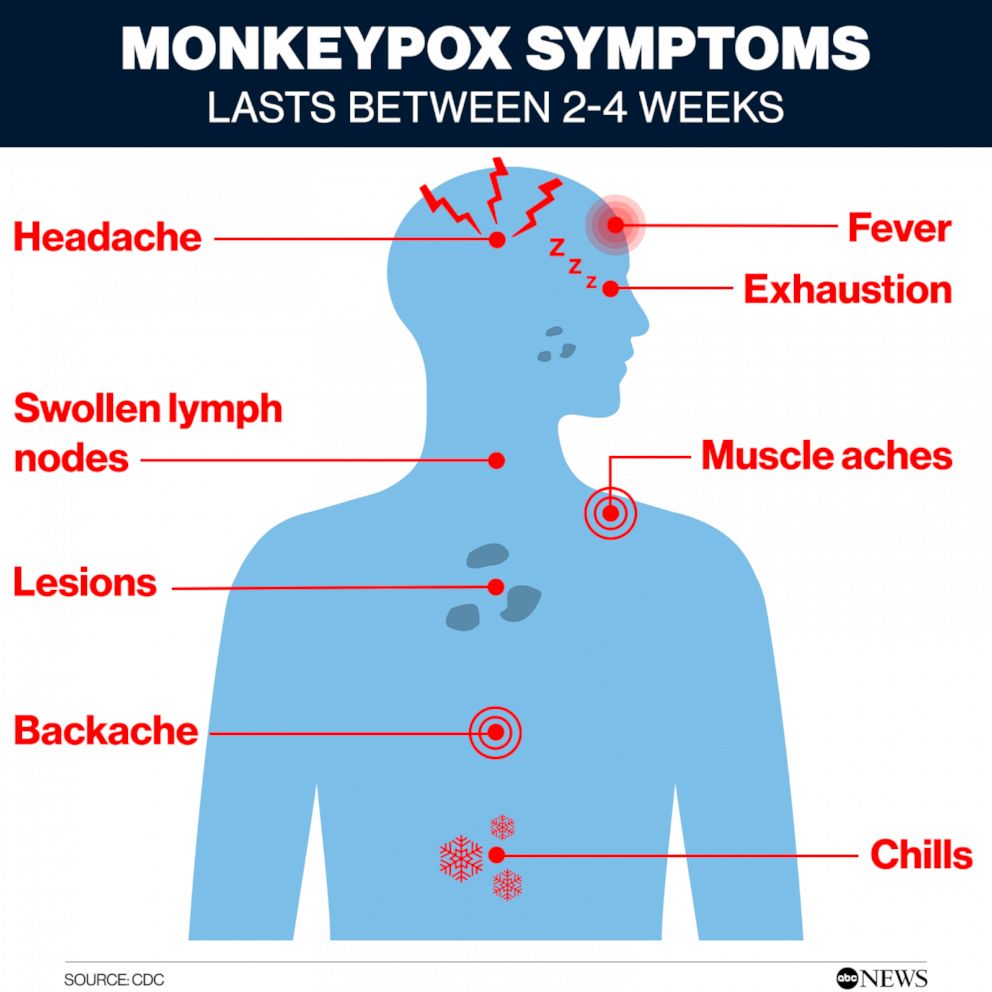 Monkey pox