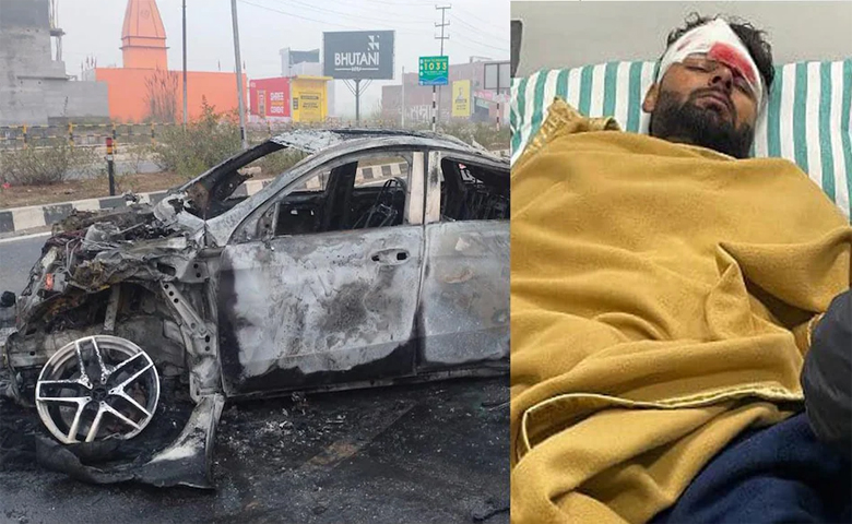 Rishabh Pant Car Accident Image