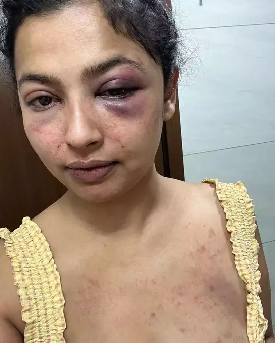 Actress Anicka Vikhraman