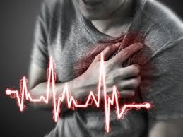 heart attack