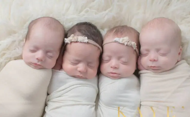 Aho Astonishing: Miracle of Nature or Medical Mystery, Woman Gives Birth to 4 Children in 5 Days, hum dekhenge news