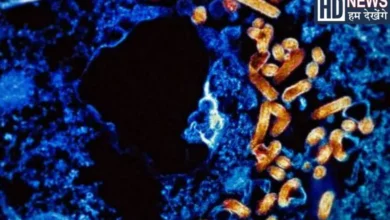 Ebola virus wreaks havoc in Congo and Uganda: DGCA issues SOP for airlines, hum dekhenge news