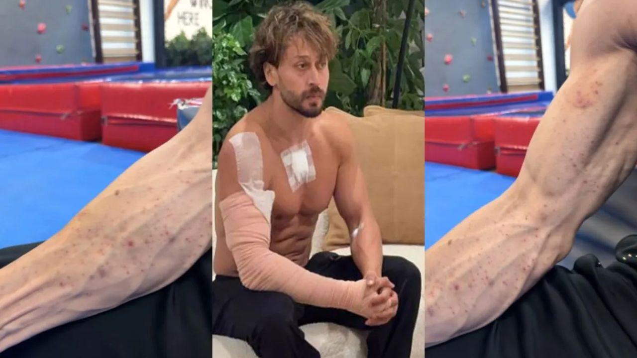 Video of Tiger Shroff's injuries after the firing incident surfaces; marks visible on his body.