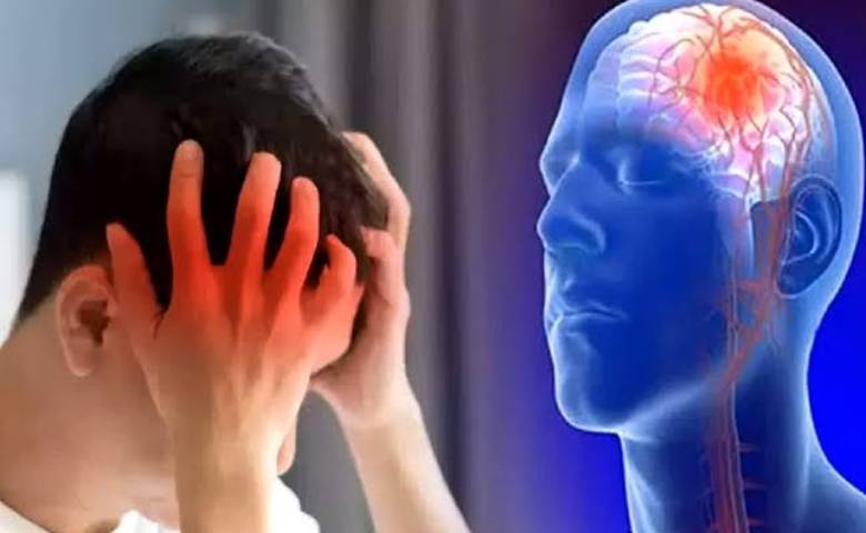 young people brain stroke symptoms