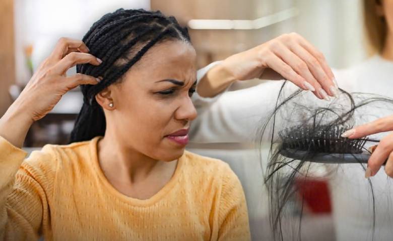 Scalp Itching Dandruff