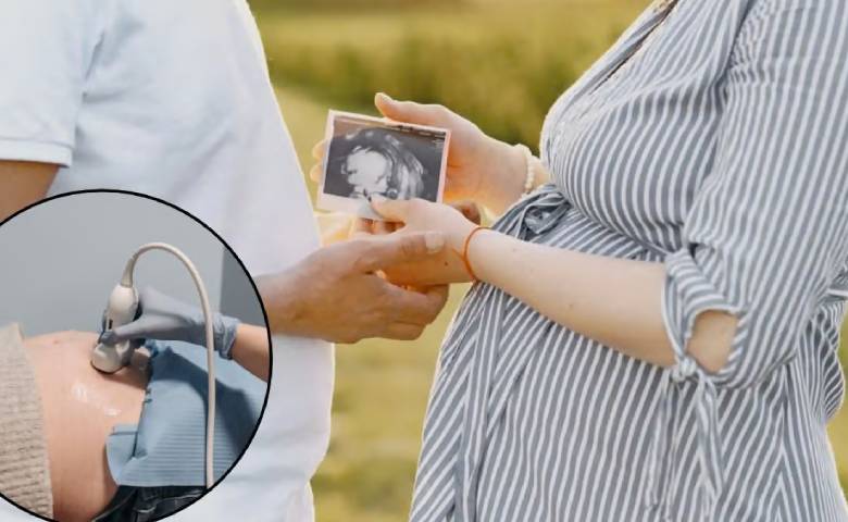 Ultrasound During Pregnancy